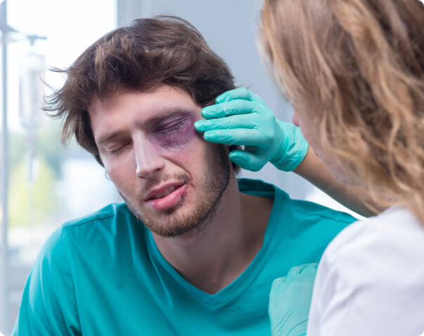 Doctor treating man with a black eye